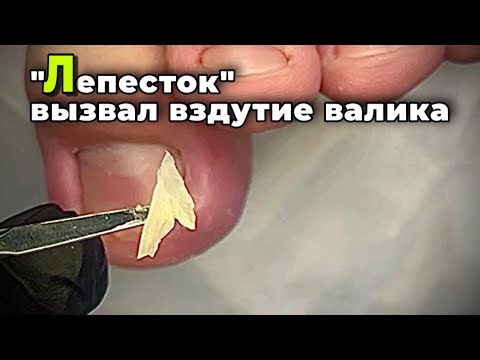 Видео: Не рабочая схема: помогу себе сам, дешевле в салоне чем у подолога