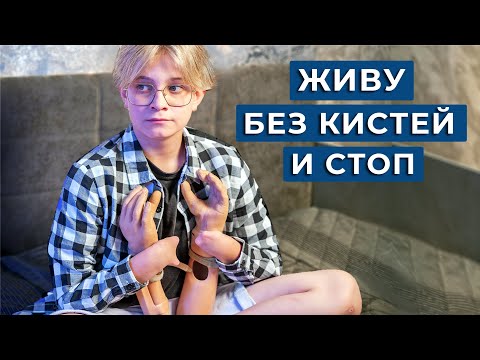 Видео: Мальчик без КИСТЕЙ и СТОП / Думаете, его жизнь — ад? А вот и нет!
