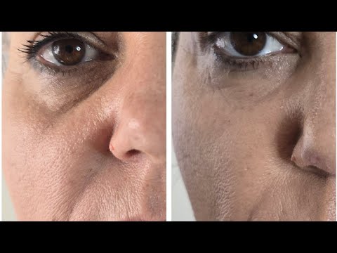 Видео: Косметический сеанс на улучшение тонуса и уменьшение морщин!