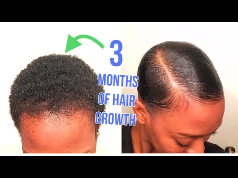 Видео: KINKY TWA SLICK DOWN *ТОЛЬКО С ИСПОЛЬЗОВАНИЕМ КОНТРОЛЯ КРАЕВ*