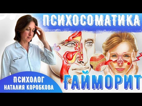 Видео: Гайморит Психосоматика