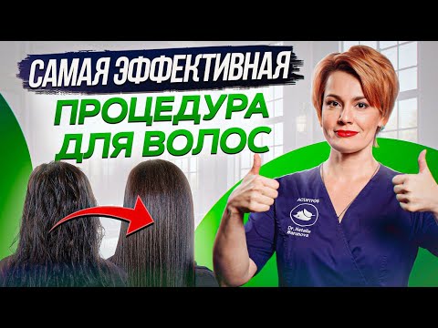 Видео: КРЕПКИЕ и ГУСТЫЕ волосы после ОДНОЙ процедуры! / Что такое карбокситерапия?