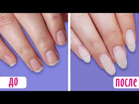 Видео: КАК ОТРАСТИТЬ ДЛИННЫЕ НОГТИ ЗА НЕДЕЛЮ ♡