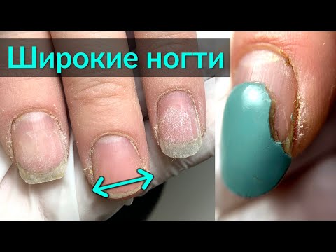 Видео: Как исправить ШИРОКИЕ НОГТИ с помощью наращивания подходящей ФОРМЫ