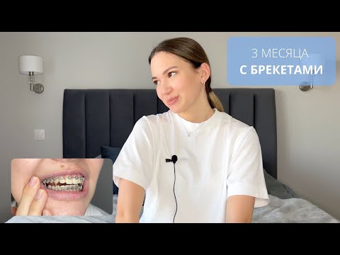 Видео: 3 МЕСЯЦ С БРЕКЕТАМИ 🤓 || УРА! || СПИЛИЛИ? || ЗАБАВНЫЕ СЛУЧАИ 🤣