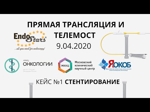 Видео: Эндоскопическое стентирование. Онлайн трансляция. Эндо Старс (Endo Stars LLC).