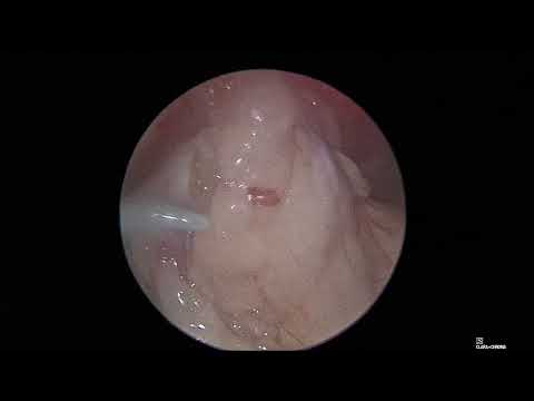 Видео: овариоэктомия самки собаки