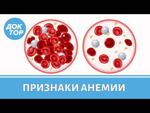 Видео: Как диагностировать анемию. Отчего кровь в моче. Что такое латентный дефицит железа