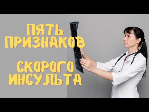 Видео: 5 признаков скорого инсульта. Доктор Лисенкова