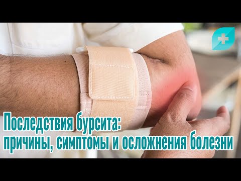 Видео: Последствия бурсита: причины, симптомы и осложнения болезни