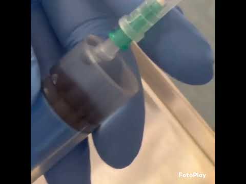 Видео: как вытеснить воздух из шприца.