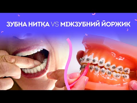 Видео: Зубна нитка і Міжзубний йоржик | Як користуватись та що краще? | Stoma Talk