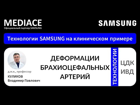 Видео: Деформации брахиоцефальных артерий (БЦА). Протокол УЗИ на клиническом примере