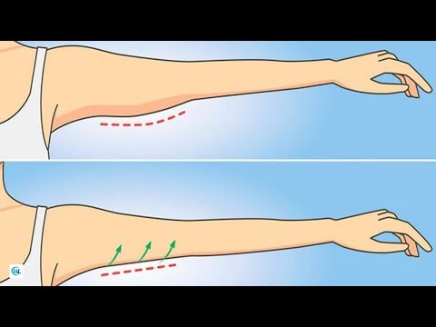 Видео: Дряблость кожи на руках. Как подтянуть?