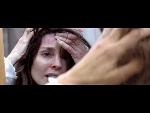 Видео: История одного человека, живущего с псориазом