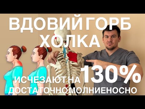 Видео: ВДОВИЙ ГОРБ и ХОЛКА на шее СУТУЛОСТЬ исчезают на 120%после этого упражнения очень молниеносно быстро