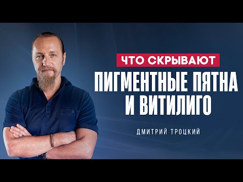 Видео: ЧТО СКРЫВАЮТ ПИГМЕНТНЫЕ ПЯТНА И ВИТИЛИГО