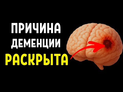 Видео: Почему старые советы о деменции не работают?