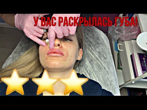 Видео: ТРЭШ САЛОН / косметолог / УВЕЛИЧЕНИЕ ГУБ