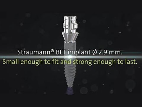 Видео: Установка имплантата Straumann BLT 2,9мм.