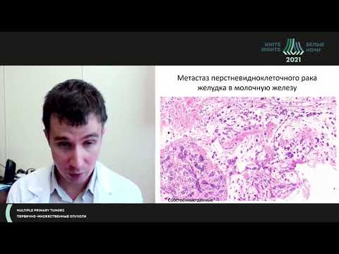 Видео: Что такое первично-множественная опухоль? (Раскин Г.А.)