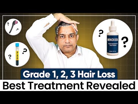 Видео: Лечение выпадения волос (1, 2, 3 степени) и остановка поредения волос естественным путем — лучшее...