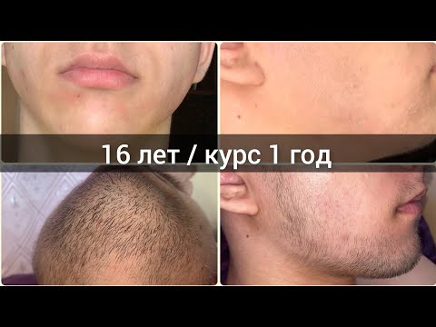Видео: Борода в 16 лет. Как я запустил рост бороды с нуля. Андрей Борода Выпуск 72
