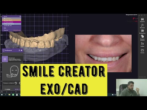 Видео: smile creator in exocad. Дизайн улыбки с помощью фото, цифровое моделирование зубов.