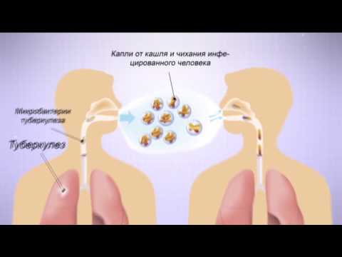 Видео: Опасность туберкулеза: как избежать смертельных бактерий? - СТОП 5, 15.01.2017