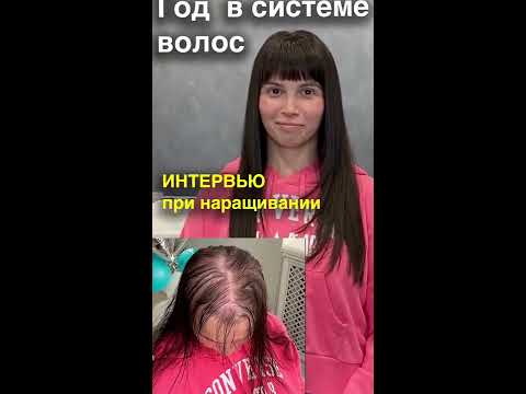 Видео: Год жизни с системой волос. Открытое интервью во время коррекции системы.