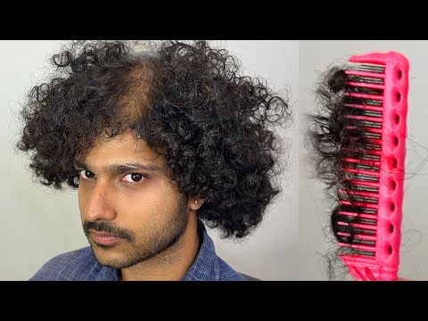 Видео: У него ВЫПАЛИ волосы ДО ТОГО, КАК Я НАЧАЛА