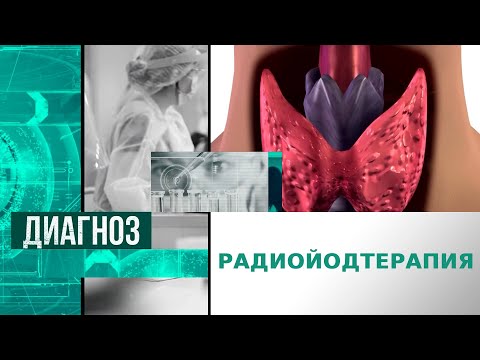 Видео: Радиойодтерапия: қалқанша безі қатерлі ісігін қалай емдейді? | Диагноз