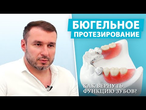 Видео: Бюгельный протез: современный и удобный способ замены нескольких зубов