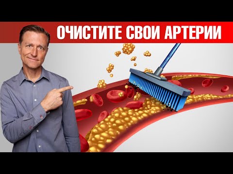 Видео: Бляшки в сосудах? Лучший обед для сердечно-сосудистой системы👍