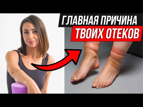 Видео: Главные причины ОТЁКОВ. Что делать?