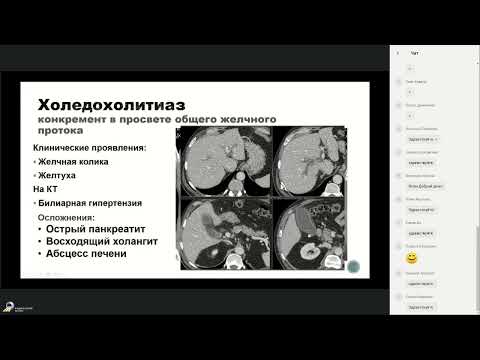 Видео: КТ живота для начинающих   острый живот