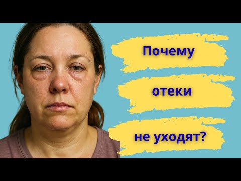 Видео: Почему отеки не уходят: ошибки, которые мы допускаем.