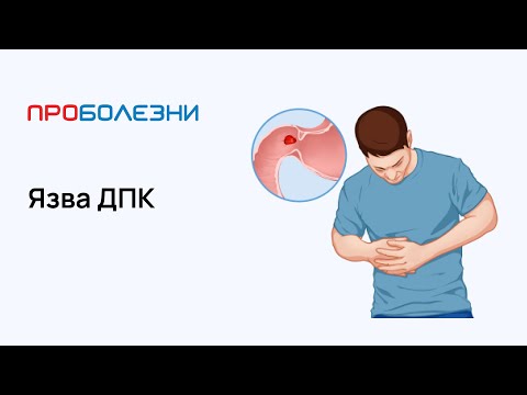 Видео: Язва ДПК (двенадцатиперстной кишки)