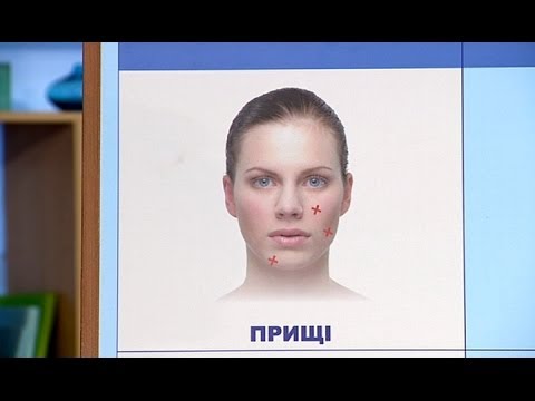 Видео: Маскируем проблемы кожи лица - Все буде добре - Выпуск 354 - 11.03.14 - Все будет хорошо