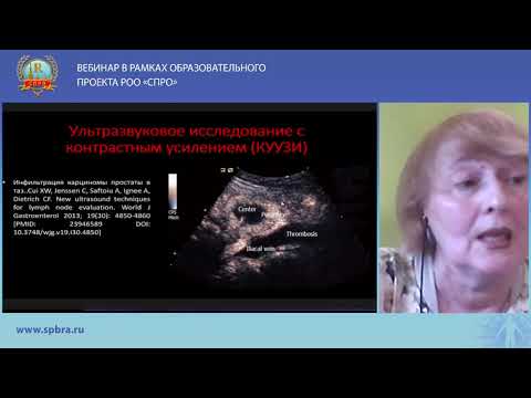 Видео: Латышева А.Я. Ультразвуковое обследование лимфатических узлов