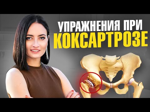 Видео: ПОСЛЕ 40 лет у 80% людей уже есть коксартроз | Простой ТЕСТ и упражнения при коксартрозе