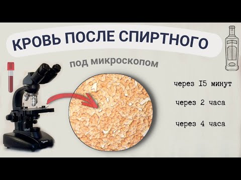 Видео: Водка, коньяк - как влияют на состояние крови