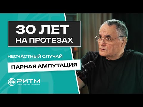 Видео: 30 ЛЕТ НА ПРОТЕЗАХ. ПАРНАЯ АМПУТАЦИЯ.