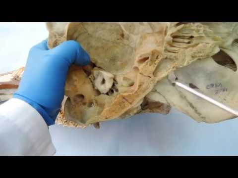 Видео: Видеозанятие 6 "Кости черепа"