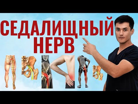 Видео: Седалищный нерв қисилиши. Бел оғриғидан бутунлай қутилинг