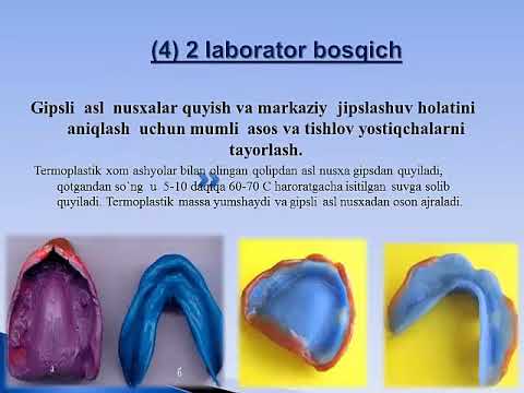 Видео: Тулик олинадиган протезларни тайорлашда клиник лаборатор боскичлар