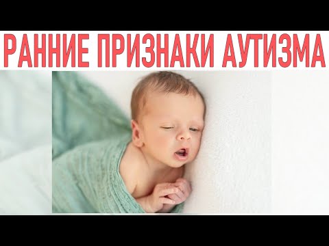 Видео: АУТИЗМ У ДЕТЕЙ | Признаки аутизма у детей младше 3 лет