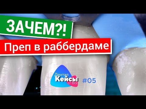 Видео: Препарирование в раббердаме. Какие есть преимущества? Дентал Кейсы от BG. #05
