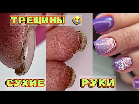 Видео: Трещины на пальцах 💅 Особенности работы с сухими руками 💅 Маникюр