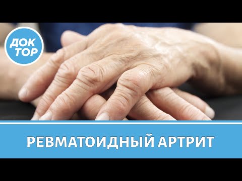 Видео: Ревматоидный артрит | Причины появления, симптомы, лечение